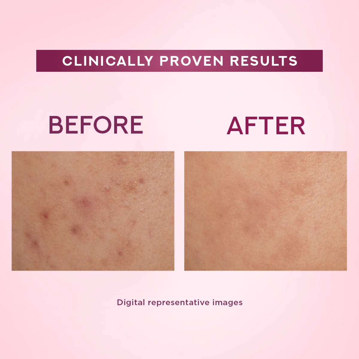 Bright Beauty Creme With UV Filter Niasorcinol Spot Repair Formula